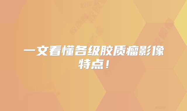 一文看懂各级胶质瘤影像特点！