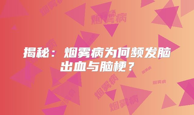 揭秘：烟雾病为何频发脑出血与脑梗？