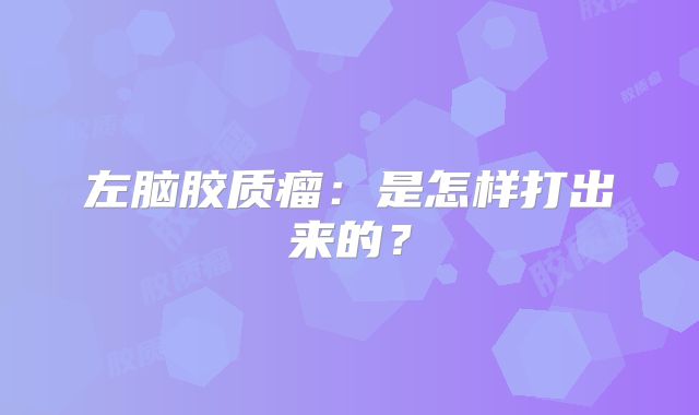 左脑胶质瘤：是怎样打出来的？