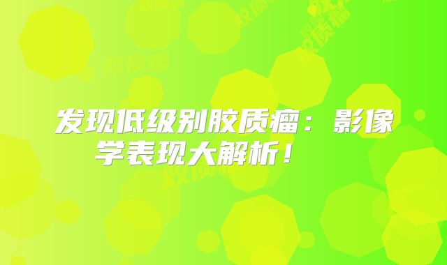 发现低级别胶质瘤：影像学表现大解析！  