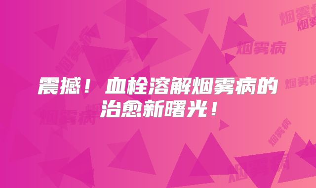 震撼！血栓溶解烟雾病的治愈新曙光！