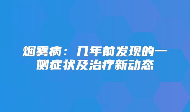 烟雾病：几年前发现的一侧症状及治疗新动态