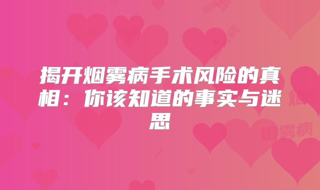 揭开烟雾病手术风险的真相：你该知道的事实与迷思
