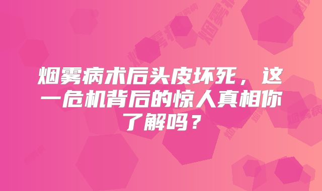 烟雾病术后头皮坏死，这一危机背后的惊人真相你了解吗？