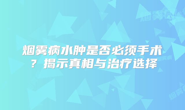 烟雾病水肿是否必须手术？揭示真相与治疗选择