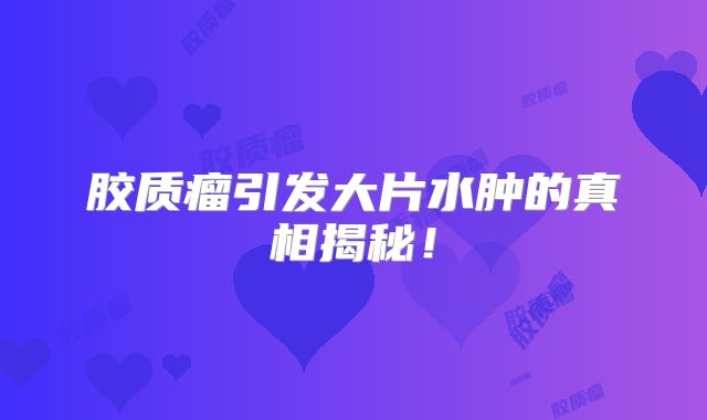 胶质瘤引发大片水肿的真相揭秘！