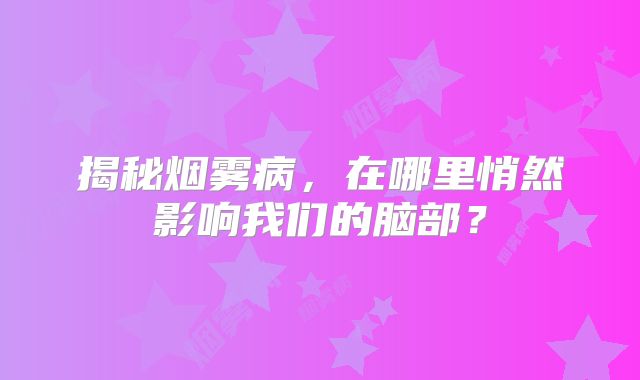 揭秘烟雾病，在哪里悄然影响我们的脑部？