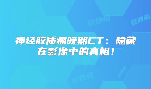 神经胶质瘤晚期CT：隐藏在影像中的真相！
