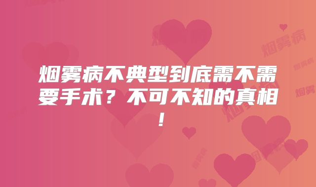 烟雾病不典型到底需不需要手术？不可不知的真相！