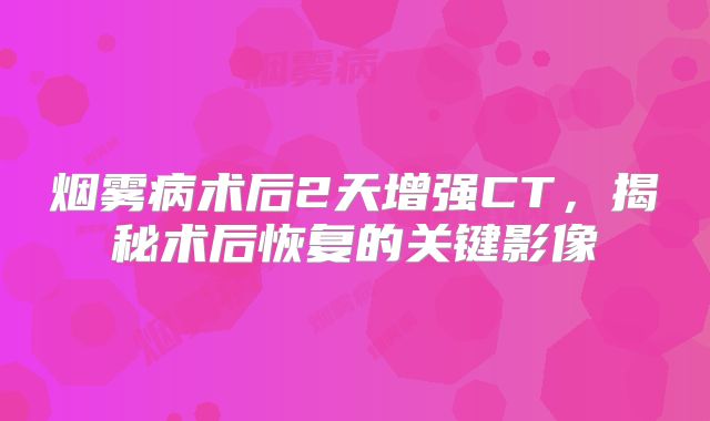 烟雾病术后2天增强CT，揭秘术后恢复的关键影像