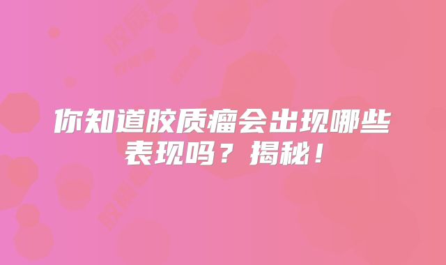 你知道胶质瘤会出现哪些表现吗？揭秘！