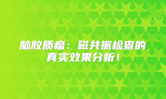 脑胶质瘤：磁共振检查的真实效果分析！