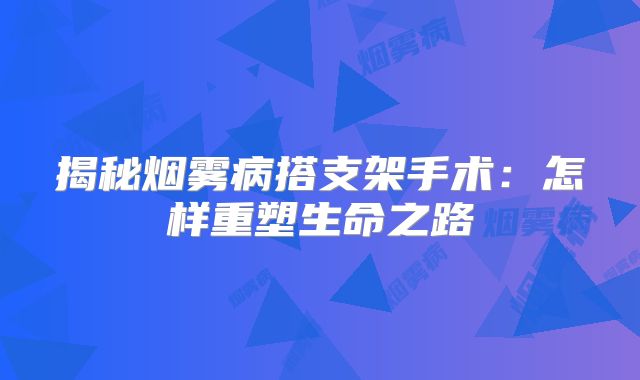 揭秘烟雾病搭支架手术：怎样重塑生命之路