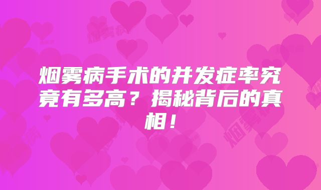 烟雾病手术的并发症率究竟有多高？揭秘背后的真相！