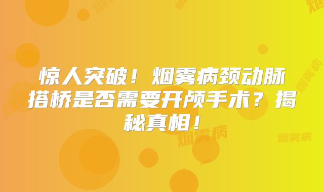 惊人突破！烟雾病颈动脉搭桥是否需要开颅手术？揭秘真相！