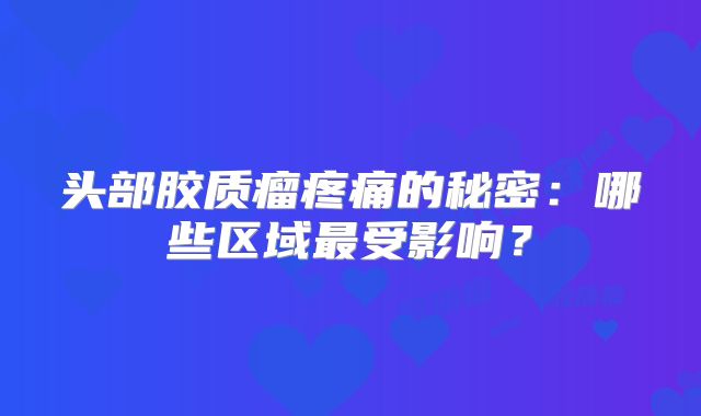 头部胶质瘤疼痛的秘密：哪些区域最受影响？