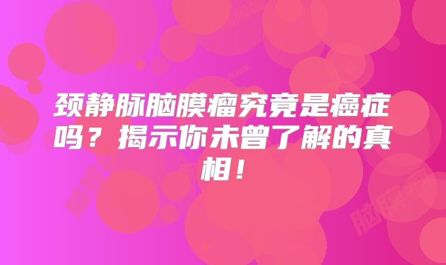 颈静脉脑膜瘤究竟是癌症吗？揭示你未曾了解的真相！