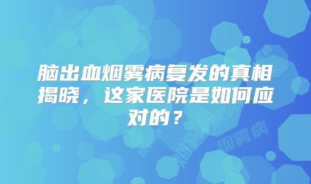 脑出血烟雾病复发的真相揭晓，这家医院是如何应对的？