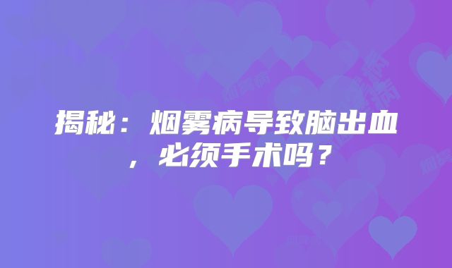 揭秘：烟雾病导致脑出血，必须手术吗？