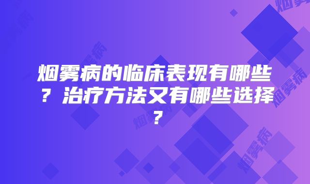 烟雾病的临床表现有哪些？治疗方法又有哪些选择？