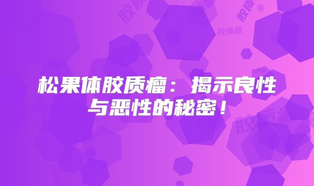 松果体胶质瘤：揭示良性与恶性的秘密！