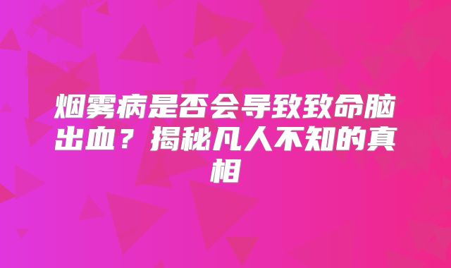 烟雾病是否会导致致命脑出血？揭秘凡人不知的真相