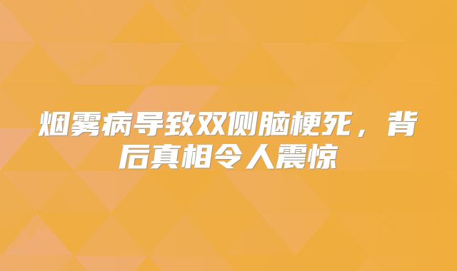 烟雾病导致双侧脑梗死，背后真相令人震惊