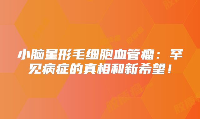 小脑星形毛细胞血管瘤：罕见病症的真相和新希望！