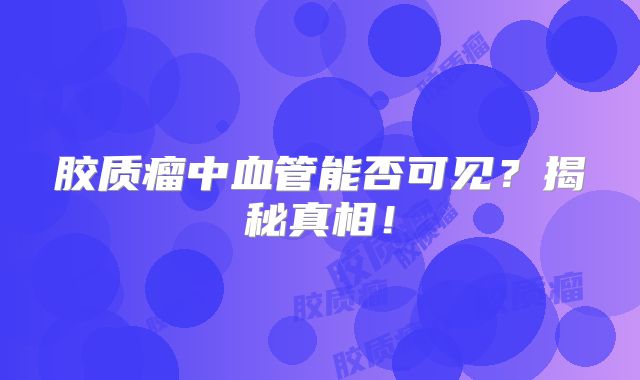 胶质瘤中血管能否可见？揭秘真相！