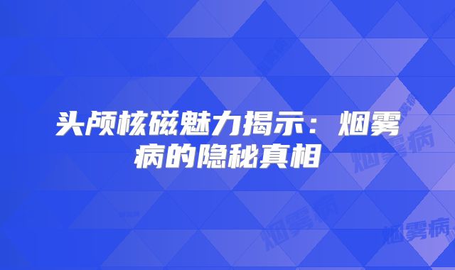 头颅核磁魅力揭示：烟雾病的隐秘真相