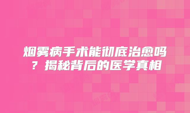 烟雾病手术能彻底治愈吗？揭秘背后的医学真相