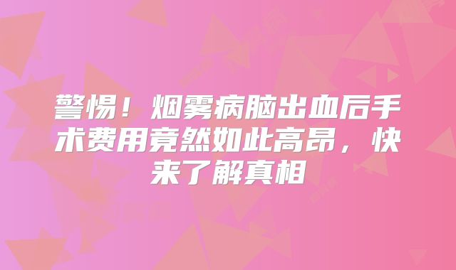 警惕！烟雾病脑出血后手术费用竟然如此高昂，快来了解真相
