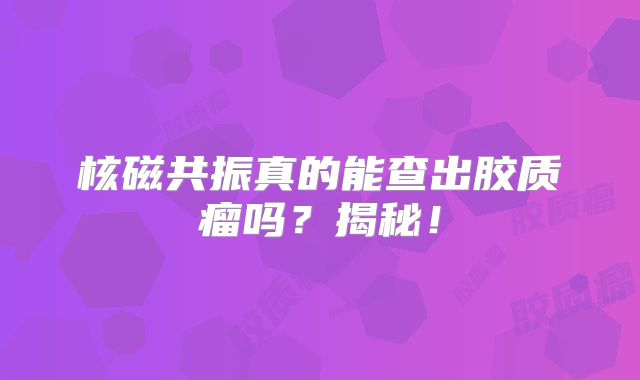 核磁共振真的能查出胶质瘤吗？揭秘！
