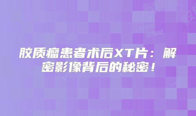 胶质瘤患者术后XT片：解密影像背后的秘密！
