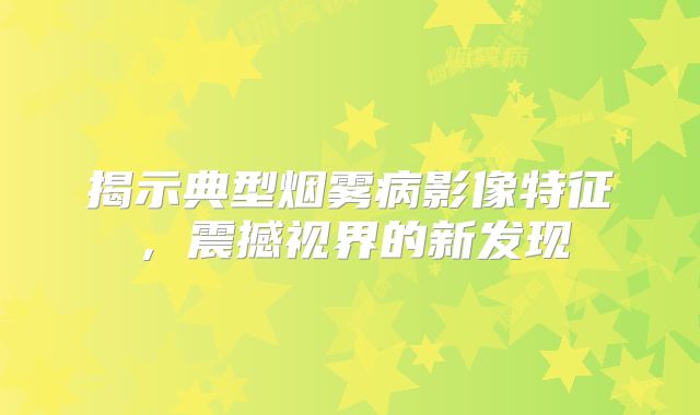 揭示典型烟雾病影像特征，震撼视界的新发现