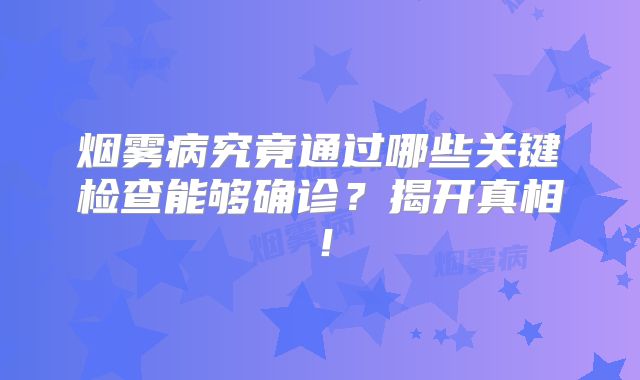 烟雾病究竟通过哪些关键检查能够确诊？揭开真相！