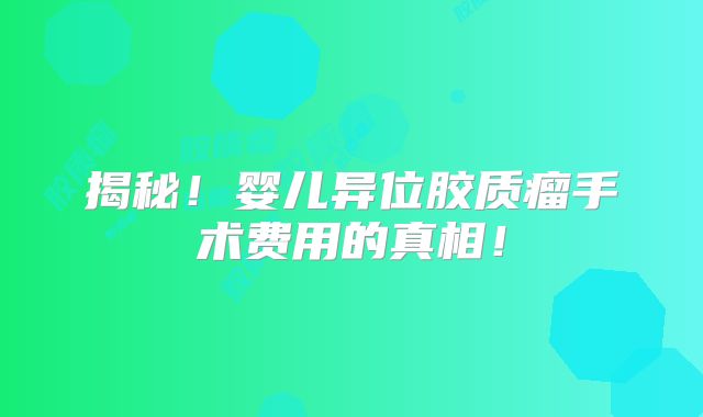 揭秘！婴儿异位胶质瘤手术费用的真相！