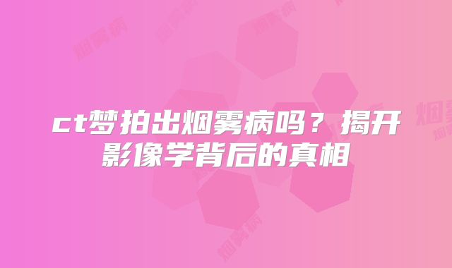 ct梦拍出烟雾病吗？揭开影像学背后的真相