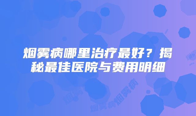 烟雾病哪里治疗最好？揭秘最佳医院与费用明细