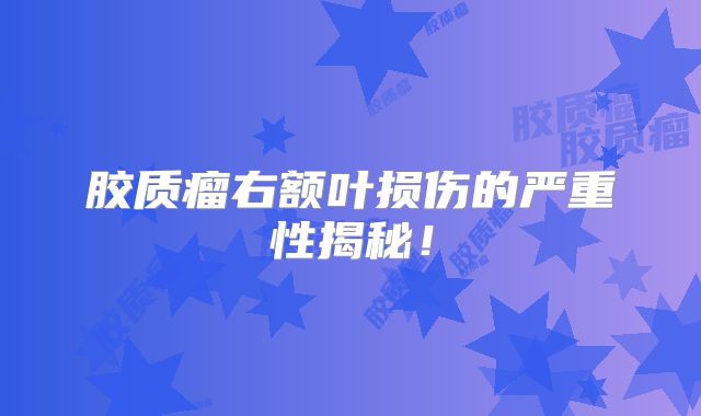 胶质瘤右额叶损伤的严重性揭秘！