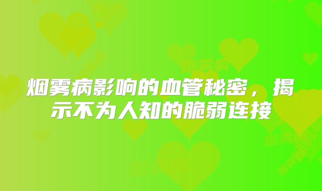 烟雾病影响的血管秘密，揭示不为人知的脆弱连接