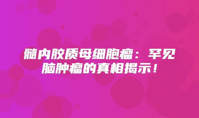 髓内胶质母细胞瘤：罕见脑肿瘤的真相揭示！