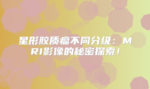 星形胶质瘤不同分级：MRI影像的秘密探索！