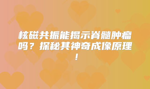 核磁共振能揭示脊髓肿瘤吗？探秘其神奇成像原理！