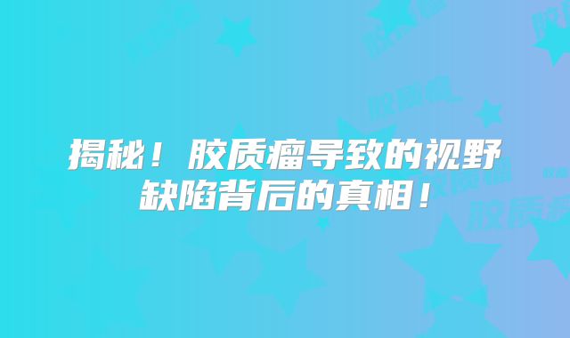 揭秘！胶质瘤导致的视野缺陷背后的真相！