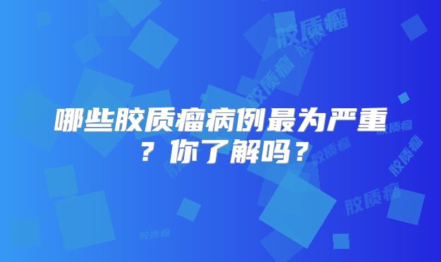 哪些胶质瘤病例最为严重？你了解吗？