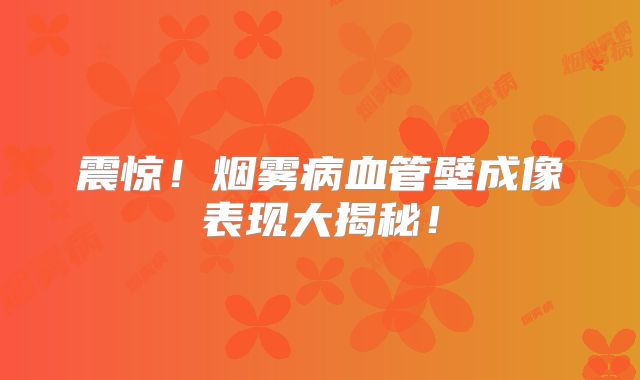 震惊！烟雾病血管壁成像表现大揭秘！