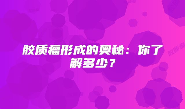 胶质瘤形成的奥秘：你了解多少？