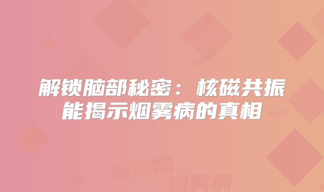 解锁脑部秘密：核磁共振能揭示烟雾病的真相