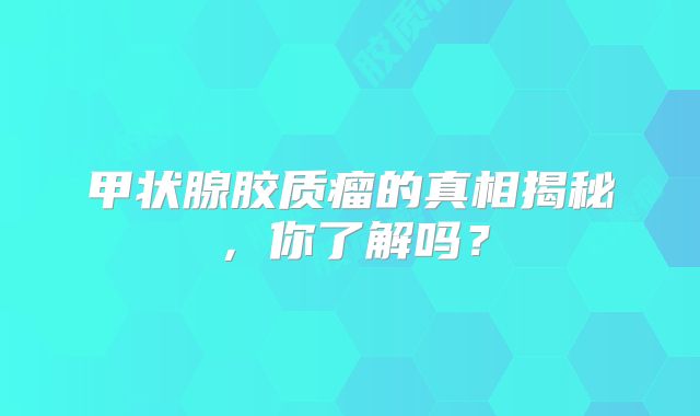 甲状腺胶质瘤的真相揭秘，你了解吗？